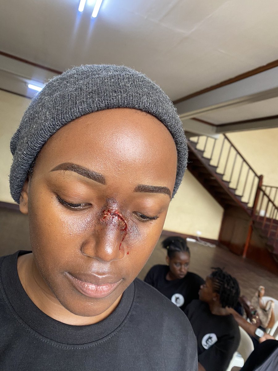 ENakaziba's tweet photo. Mentoring girls in the film makeup industry is important because it helps them gain valuable skills, knowledge, and confidence pursue a successful career in this field Of film makeup artistry
Student learning how to create #brokennose sfxmakeup look.
 #makeupclasses 
#filmmakeup https://t.co/Wa5s509kIh