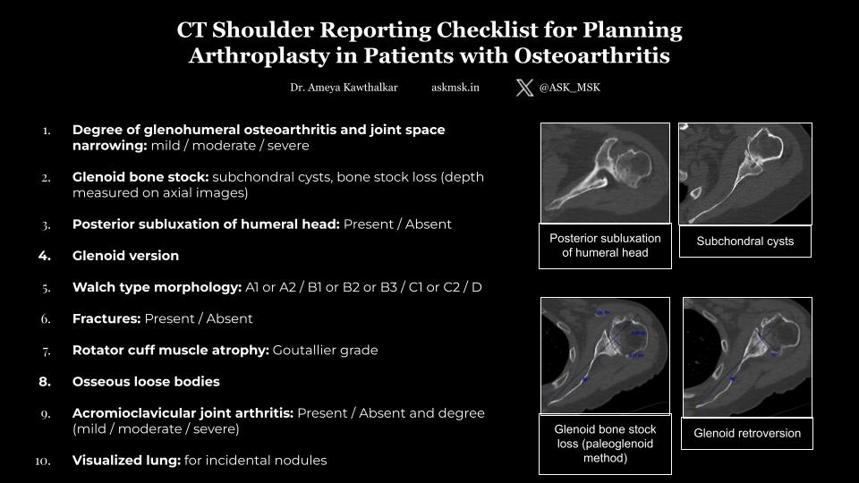 ASK_MSK's tweet photo. CT shoulder reporting checklist for planning arthroplasty in patients with osteoarthritis https://t.co/To3wMfg0bU