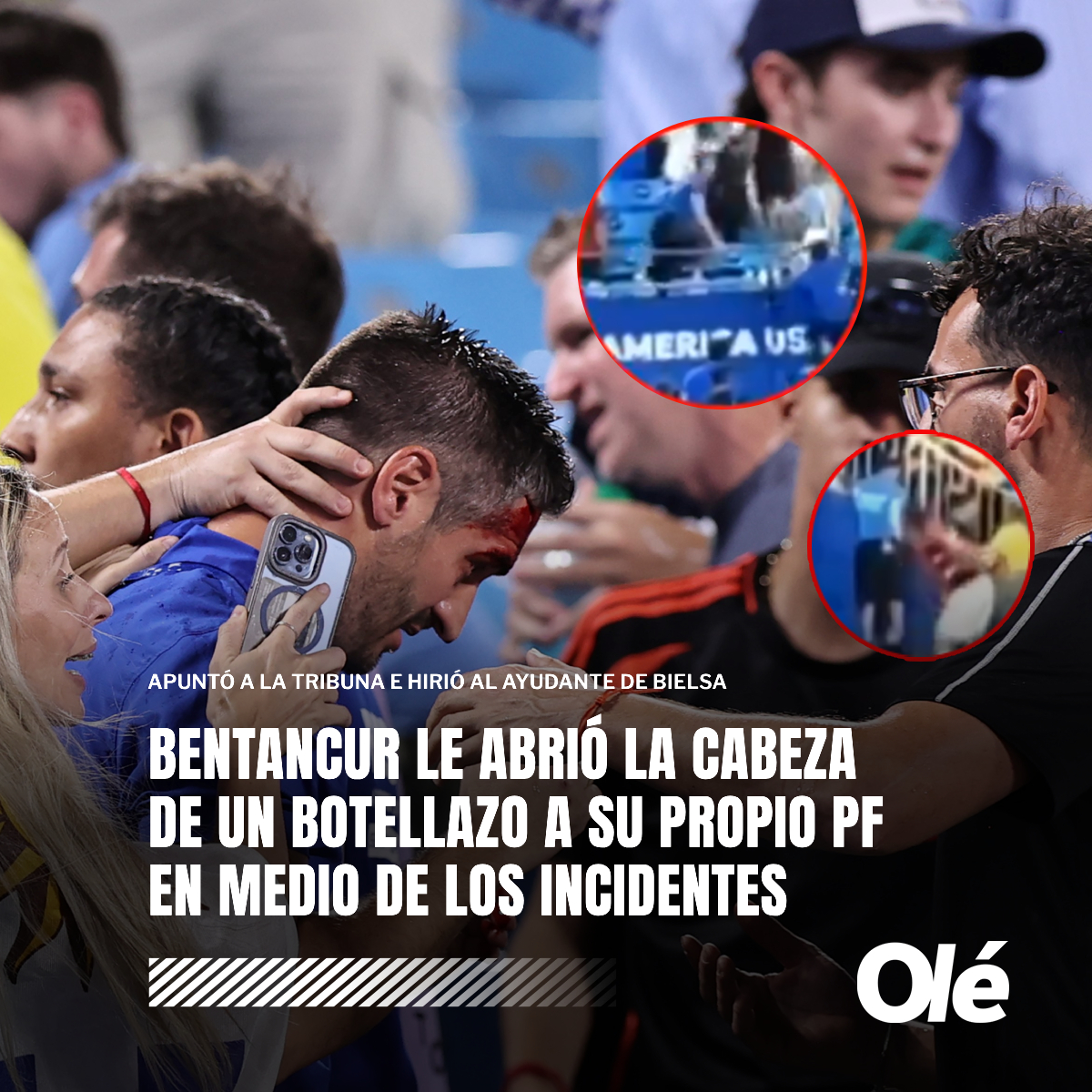 DiarioOle's tweet photo. ❗️🇺🇾 BENTANCUR LE ABRIÓ LA CABEZA DE UN BOTELLAZO A SU PROPIO PF DURANTE LOS INCIDENTES ANTE COLOMBIA 🇨🇴

⚠️🏟️ En medio de la pelea entre hinchas colombianos y jugadores uruguayos, Bentancur arrojó un proyectil a la tribuna que hirió a Santiago Ferro, miembro del staff de Bielsa

El PF terminó con un corte por encima de la ceja 🤕