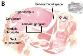 UK_headache's tweet photo. #Research article by Rasmussen et al in @ScienceMagazine on #Migraine showed that in mice cerebrospinal fluid #CSF links brain to peripheral nervous system at #trigeminal nerve. Potential signalling pathway driving headache after aura.
https://t.co/ikSyMLJeTE
#MedEd #bashhead https://t.co/LxVS8KHjbj