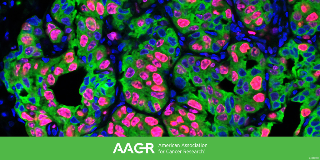AACR (@aacr) on Twitter photo Submit an abstract by September 3 for the AACR conference on Tumor-body Interactions: The Roles of Micro- and Macroenvironment in Cancer (November 17-20, Boston), chaired by <a href="/megeblad/">Mikala Egeblad</a>, <a href="/ErezNeta/">Neta Erez- ErezLab🎗️</a>, <a href="/SGrivennikov/">Sergei Grivennikov</a>, and <a href="/IMalanchi/">ilaria Malanchi</a>.
bit.ly/3zFhEnk
#AACRtumorenviron24 #AACRTME Submit an abstract by September 3 for the AACR conference on Tumor-body Interactions: The Roles of Micro- and Macroenvironment in Cancer (November 17-20, Boston), chaired by <a href="/megeblad/">Mikala Egeblad</a>, <a href="/ErezNeta/">Neta Erez- ErezLab🎗️</a>, <a href="/SGrivennikov/">Sergei Grivennikov</a>, and <a href="/IMalanchi/">ilaria Malanchi</a>.
bit.ly/3zFhEnk
#AACRtumorenviron24 #AACRTME