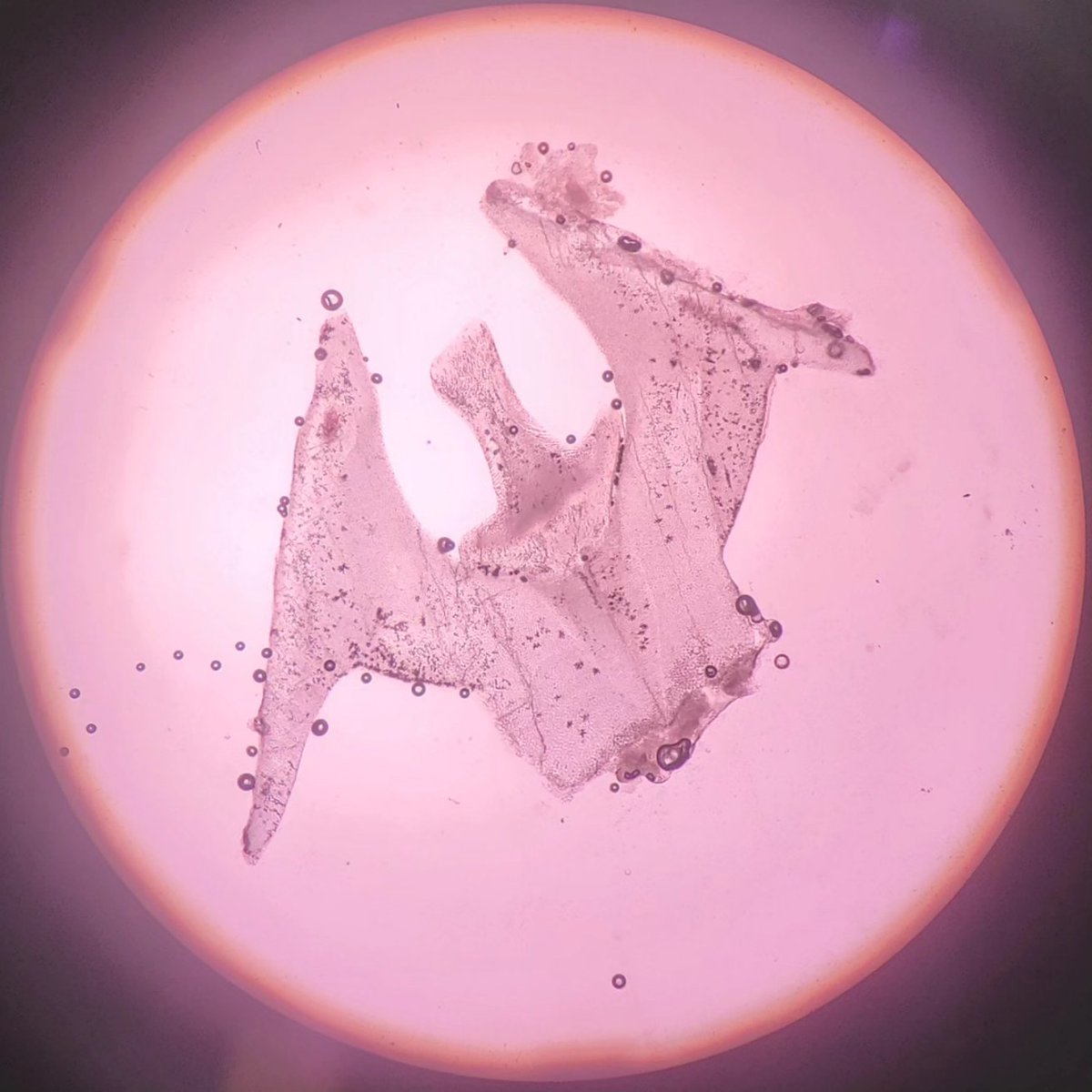 valentinity_89's tweet photo. Closing a pretty horrible week with a sea urchin's tooth cross section has uplifted my mood quite a bit
(bubbles aside 👀)
😌💖🌊

#micro #teeth #histology #microscopy https://t.co/oBivkI4YG2
