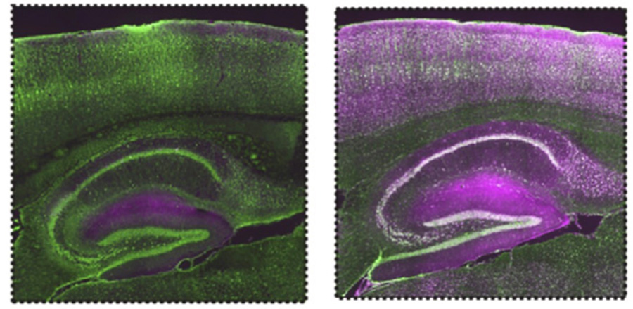 Alzforum (@alzforum) on Twitter photo The microglial protein C1q slows neuronal protein translation in the aging mouse brain. #alzheimersdisease <a href="/BostonChildrens/">Boston Children's</a> ow.ly/vPTY50SAJ5Y The microglial protein C1q slows neuronal protein translation in the aging mouse brain. #alzheimersdisease <a href="/BostonChildrens/">Boston Children's</a> ow.ly/vPTY50SAJ5Y
