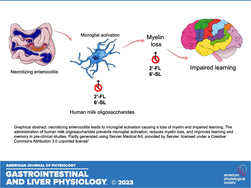 ajpgi's tweet photo. 🔓#SuggestedRead Exciting study suggests that #HumanMilkOligosaccharides could be a game-changer for preventing neuroinflammation in #PrematureInfants with #NecrotizingEnterocolitis.
🔗https://t.co/RgDNwhHjQh
@davidhackam @GraceNiemiro #breastfeeding #neonate https://t.co/Hvte3lKlws