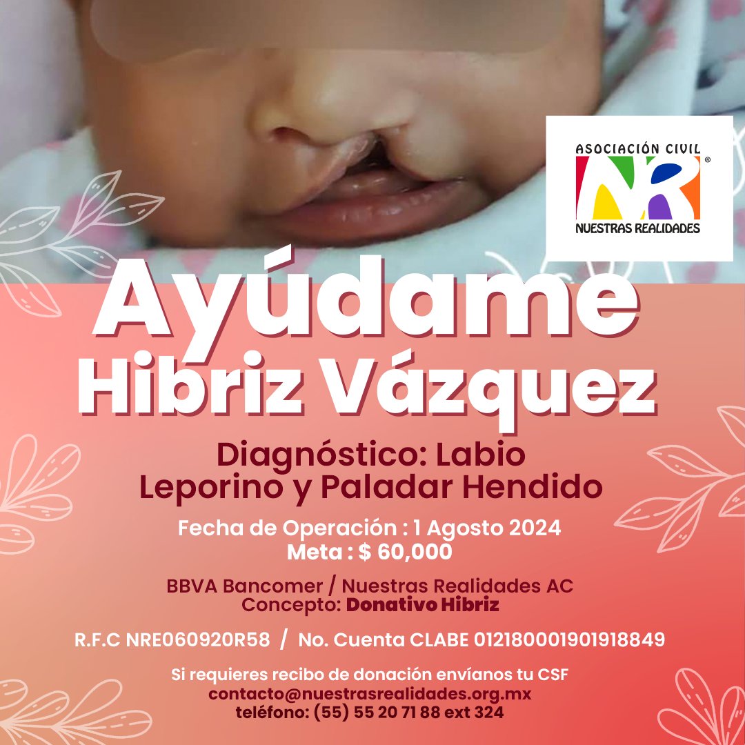 Hola soy Hibriz, tengo 3 meses de vida; mi diagnóstico es Labio Leporino y Paladar Hendido.

Necesitamos de tú ayuda para llevar a cabo un sueño y cambiar la vida de este angelito. 🍀🤗