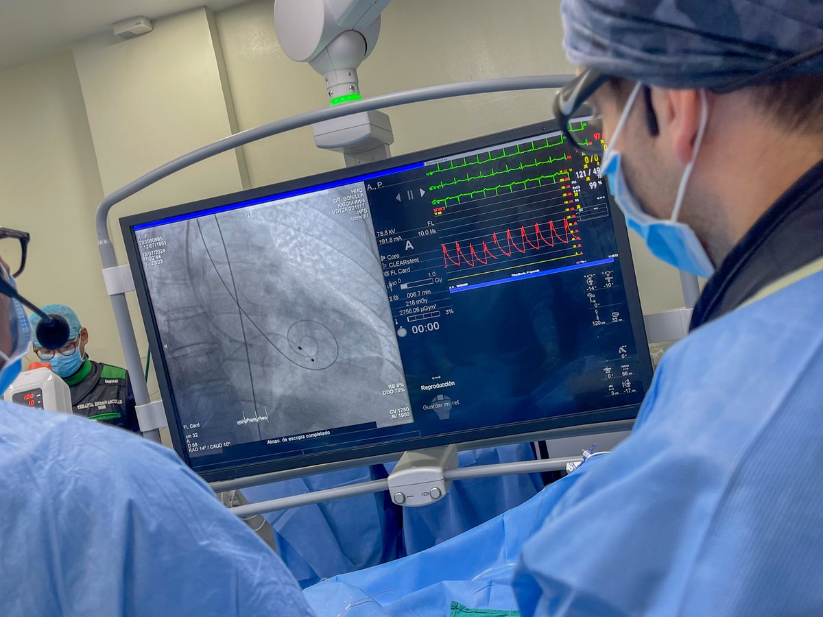 Nos mantenemos a la vanguardia de la medicina con la realización de implantes de válvula aórtica por vía percutánea (TAVI).

Hoy, durante el #IIICongresoMedicinaISSS presentamos el caso en vivo de una paciente diagnosticada con Estenosis Aórtica. 🫀👨🏻‍⚕️