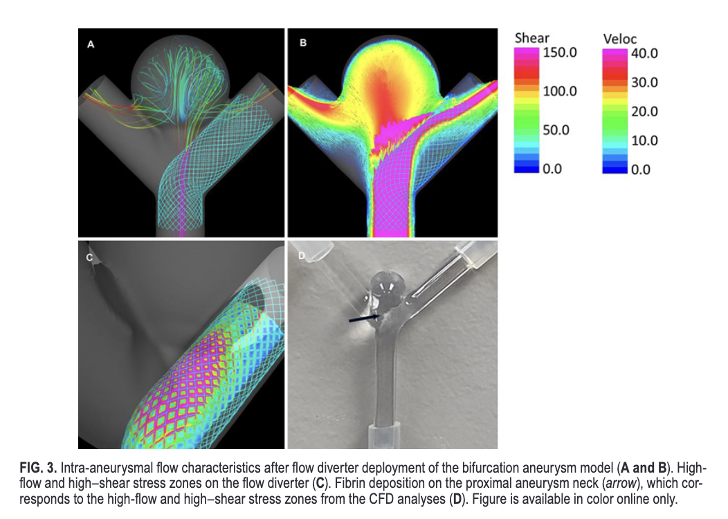 #OnlineFirst: In vitro evaluation of flow diverter performance using a human fibrinogen–based flow model. 

thejns.org/view/journals/….