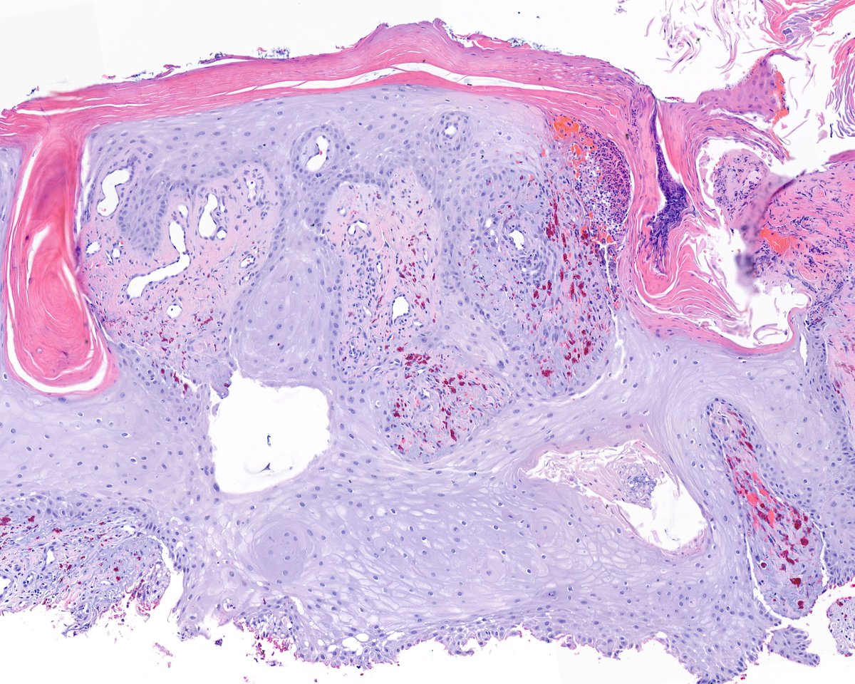 Cause and effect in action...