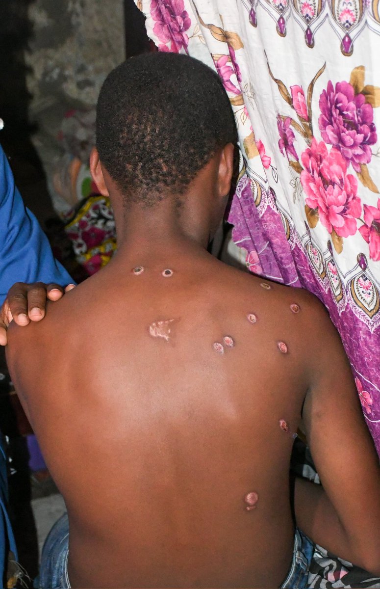 kaborus's tweet photo. On behalf of the LSK and Public Interest Litigation committee, we visited the boy who was shot several times by the police in Nakuru.

The boy is yet to resume schooling and was to go for specialised consultation on the plastic bullets lodged inside.

We will follow up and guide them till they get compensation.