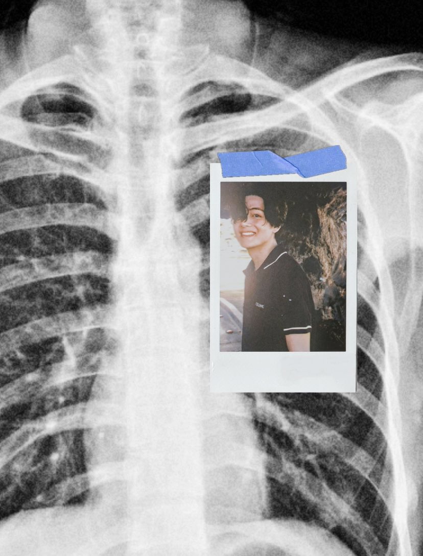taeteluv_'s tweet photo. 𑁤 https://t.co/WayNcRp0VV