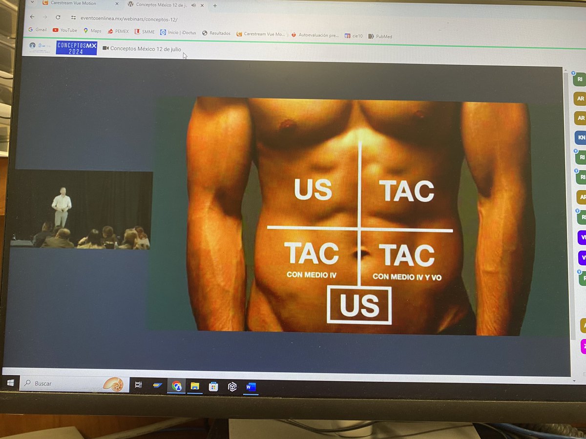 ✅ Estudio de imagen de elección por cuadrantes de acuerdo al Colegio Americano de Radiólogos en Dolor abdominal 

#ConceptosMX