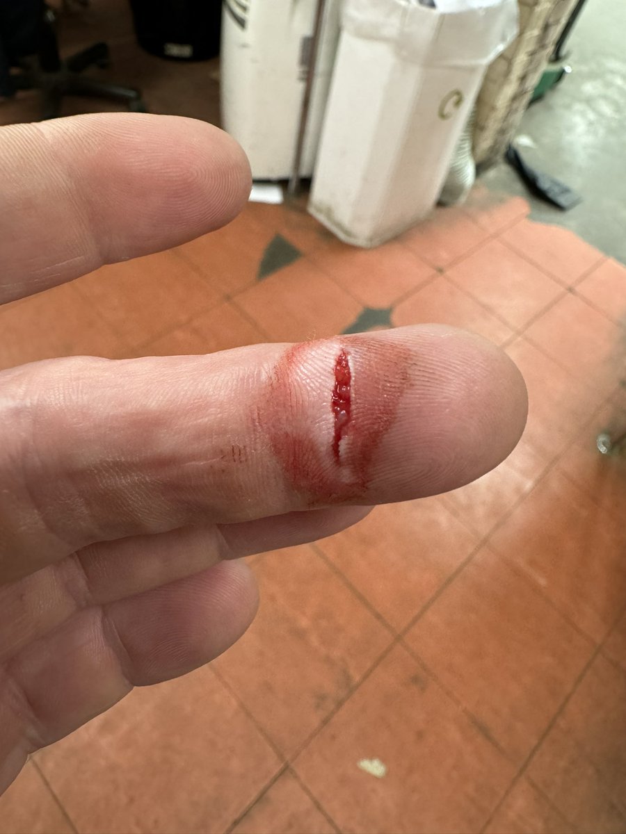 Note to self: retractable steps on trucks cut like shears when you trap your finger in the mechanism. Learning every day.