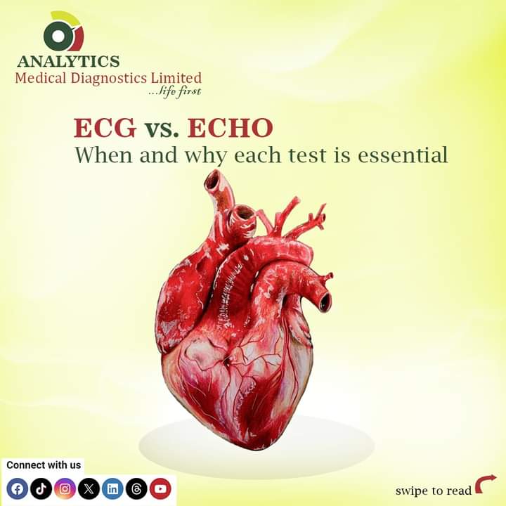 AnalyticsMDL's tweet photo. 🎤Wondering when you need an ECG or ECHO? Here's a quick guide:

ECG (Electrocardiogram):
For chest pain, palpitations, dizziness, shortness of breath, fainting, unexplained fatigue, and abnormal heart rates. https://t.co/aBm7y8XIoS