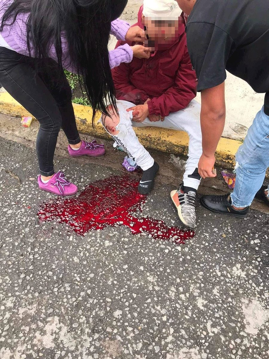OigaEdomex's tweet photo. #violencia Iban a linchar a #Policias que antes atropellaron y golpearon con salvajismo a dos jóvenes 
Información completa en: https://t.co/DWnsrDDpsg https://t.co/aglkTGy3PX