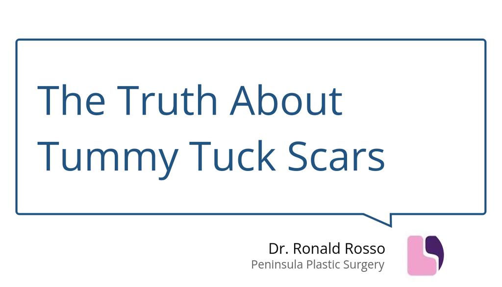 DrRonaldRosso's tweet photo. Follow Plastic Surgeon's Instructions: Adherence to your plastic surgeon's postoperative care is crucial to ensure proper healing.

Read more 👉 https://t.co/nce5VOjRL6

#TummyTuckScars #ProactiveSteps #Plasticsurgery #Beauty #ImproveBloodFlow #DrRossoTorrance #plasticsurgery https://t.co/TSJ4rL0vTK