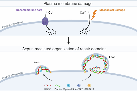 emboreports's tweet photo. Stephanie Seveau @SeveauLab and co-workers @OSUWexMed @OhioState show that the #septin #cytoskeleton is required for #plasma #membrane #repair in response to #wounding.
-> https://t.co/OavAWAoKD1 https://t.co/AgiODVsrsC