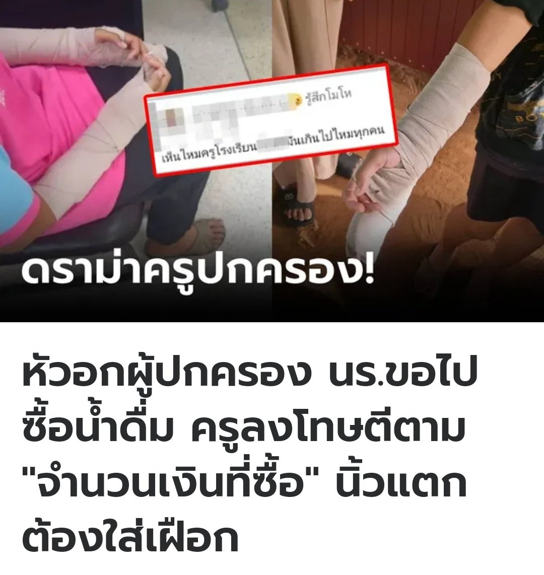 สงสารน้องมาก น้องขอครูประจำชั้นไปซื้อน้ำ กลับมาเจอครูฝ่ายปกครองลงโทษ ตีมือน้อง 20 ที ตามจำนวนเงินที่ซื้อน้ำ นิ้วมือแตกต้องเข้าโรงพยาบาลใส่เฝือกเลย ขอให้น้องได้รับความเป็นธรรมด้วยนะครับ!!!!!