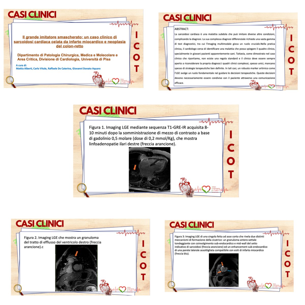 ICOT Clinical Case of the Week

🫀Il grande imitatore smascherato: un caso clinico di sarcoidosi cardiaca celata da infarto miocardico e neoplasia del colon-retto🫀

📍Presto sul nostro sito