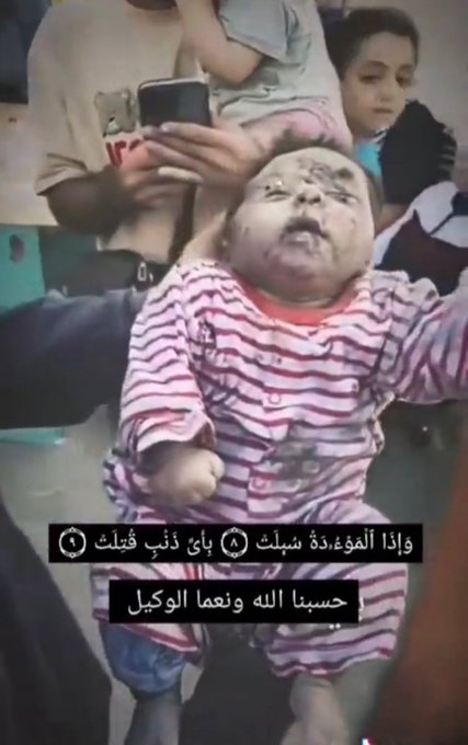 Afcq1954's tweet photo. بأي ذنب قتلت؟؟ https://t.co/Ri0elcmDrb