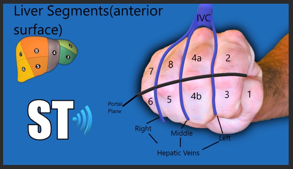 Shaman___S's tweet photo. Liver Segments 
مهم تعرفها وتعرف تقسيمتها بس لاتتعب نفسك في حفظها اذا انت في بداياتك https://t.co/d8GWWnMLJt