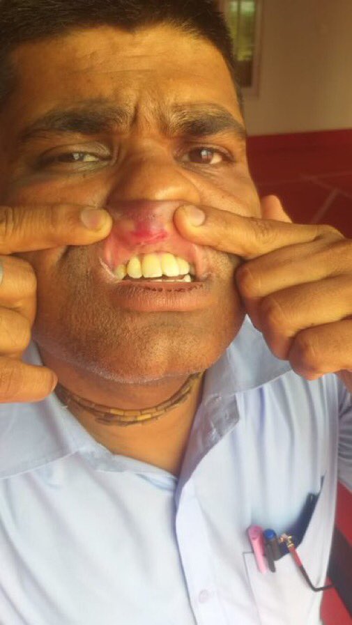 jsuryareddy's tweet image. Shocking
Baikuntha Pradhan, ASO, Parliamentary Affairs, working at Raj Bhavan in #Odisha, alleged that he was physically #Assaulted, slapped, kicked and punched by #Governor Raghubar Das's son, Lalit Kumar and 6 others, for not sending luxury car to pick him up.

#OdishaGovernor