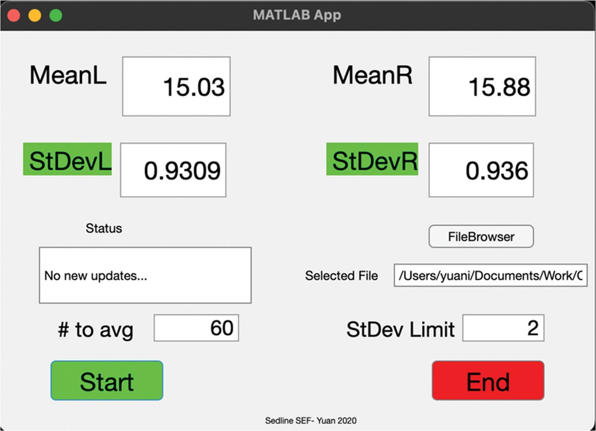 SEF95 can be a biomarker for propofol #anesthesia depth in infants, potentially improving dosing accuracy and utilization of propofol anesthesia in this population. Learn more: ow.ly/lXwe50SAI0S