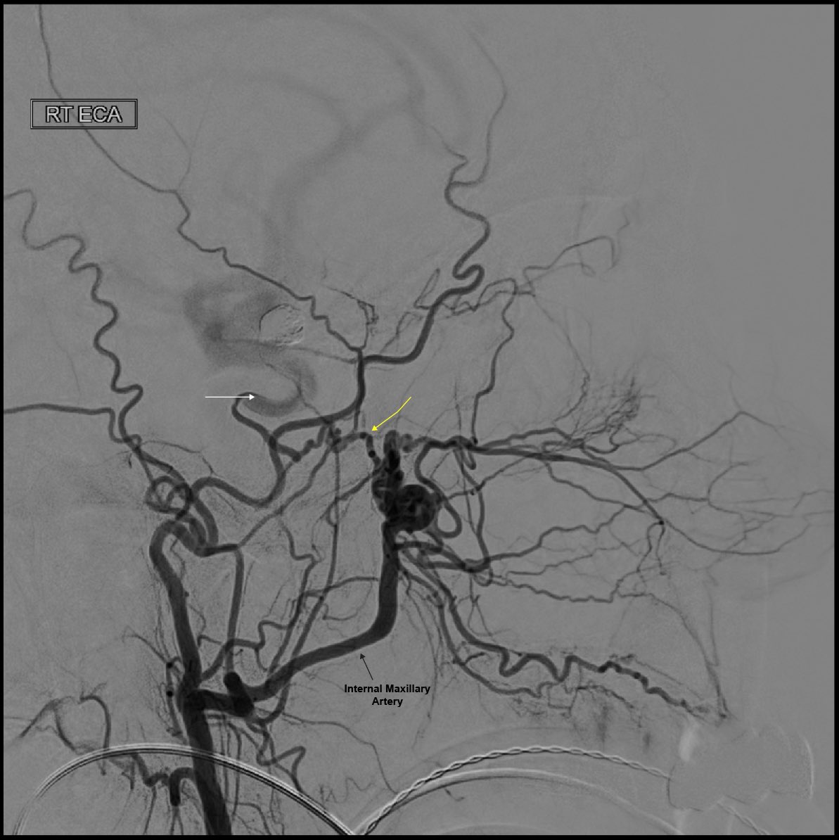 YNIS Committee tweet media