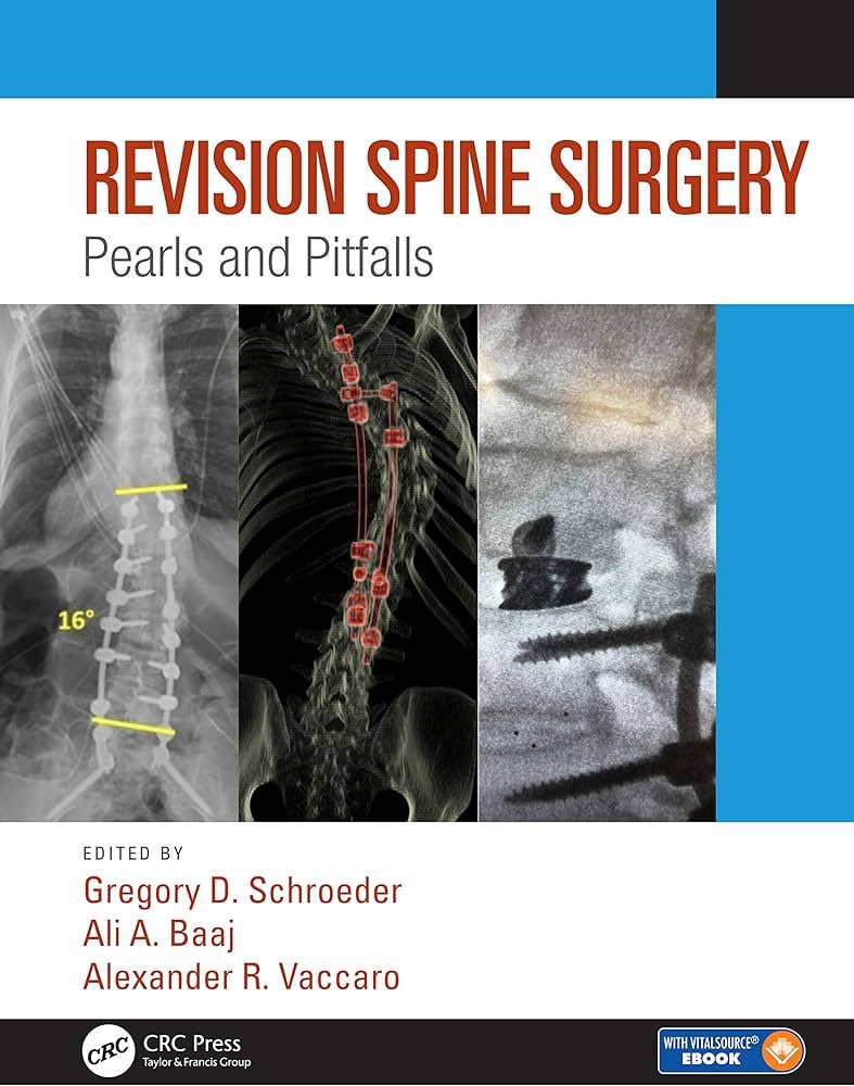 AliBaajMD's tweet photo. There’s no escaping revision spine surgery. 

But we owe it to our patients to continually improve our understanding of biomechanics, indications and surgical strategies to provide durable outcomes and decrease the need for such revisions. 

In the 2nd edition of this text, we’ll dive deep into innovative techniques that could decrease the often extensive surgical footprint of revision surgery. Perhaps endoscopy, MIS approaches, AI, or even non-op measures should be further explored. 

Ideas, suggestions, and interest in chapter authorship for the 2nd edition are welcome!