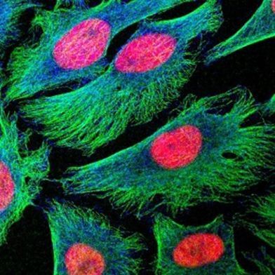 CANCEREVENT's tweet photo. Importance of Drug Sensitivity Testing in Cancer
Read More-https://t.co/iLRvT0fLFI
iCancer Conference - https://t.co/HlS74FXKey
#Cancer #Healthcare #Conference #Oncology https://t.co/NPCzgxcoaM