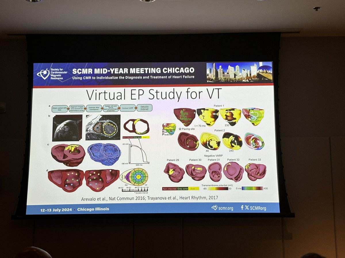 JonathanPanMD's tweet image. Enjoyed learning about the different applications of CMR in EP procedures by Dr. Bilchick! @SCMRorg #whyCMR @AmitRPatelMD @ChrisKramerMD @PRodriguezMD @PamelaMasonEP