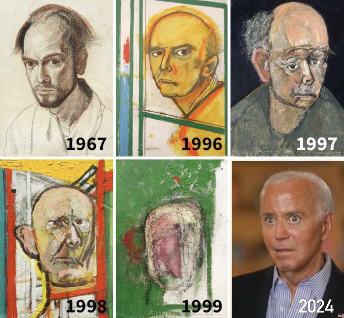 American artist William Utermohlen was diagnosed with Alzheimer's disease. In response to the illness, the London-based artist immediately began to paint an ambitious series of self-portraits.