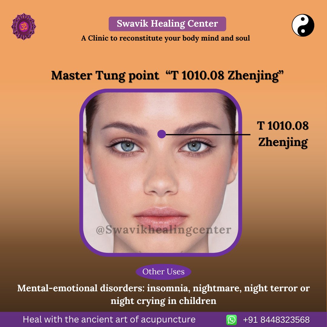 SwavikHealing's tweet image. ➡️ Master Tung point  “T 1010.08 Zhenjing”
 
#insomniaproblems #insomnia #nightmare #nightterrors #mentalemotionalhealth #mentalhealth   #Palamvihar #gurugram #treatment #acupuncturetherapy