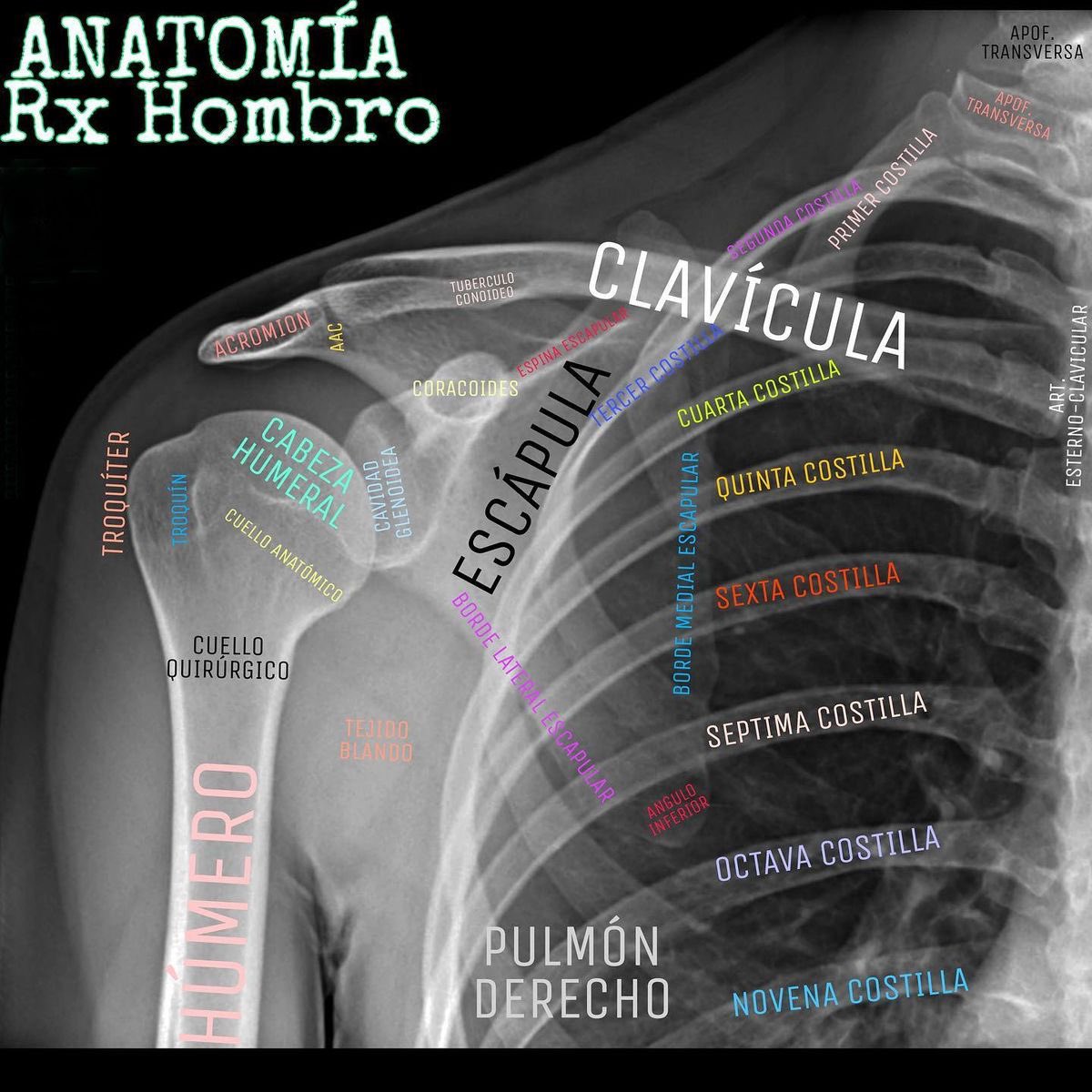 farmacotips's tweet photo. Anatomía de radiografía del hombro: https://t.co/RrLAR6zwmd