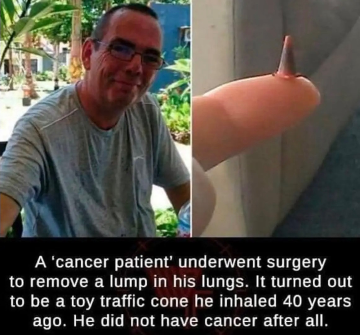 Matt Rose here! And today we're looking at weird toys people have inhaled