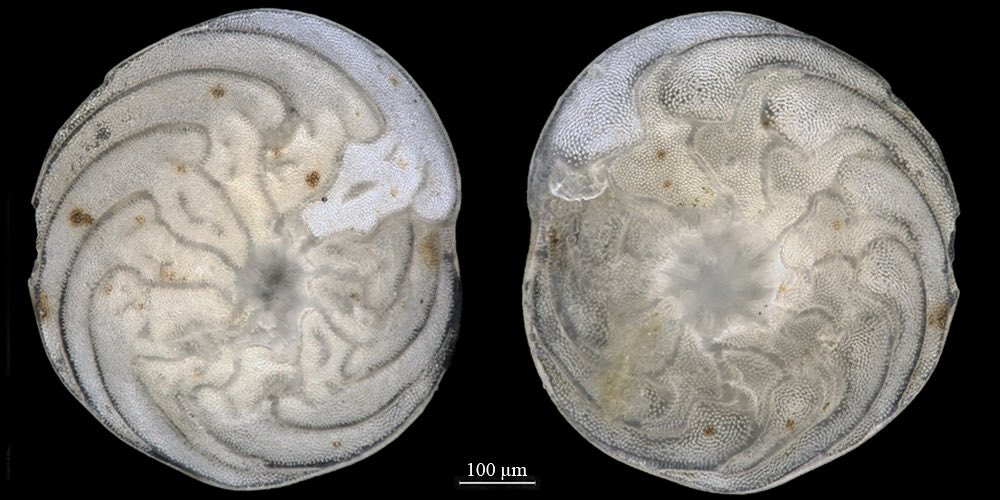 Which paper describes the difference between Amphistegina gibbosa and A. lessonii ? #foraminifera #protist #florida #shelf