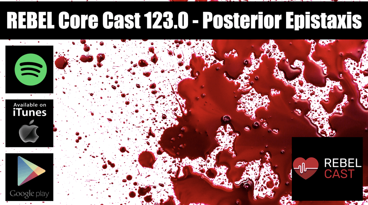 This episode of the REBEL Core Cast is about Posterior epistaxis. Which is a rare, life-threatning situation. We cover recognition and all stages of care. loom.ly/ZU2A1fI #FOAMed #FOAMcc #medicalpodcast #medicaleducation #emergencymedicine