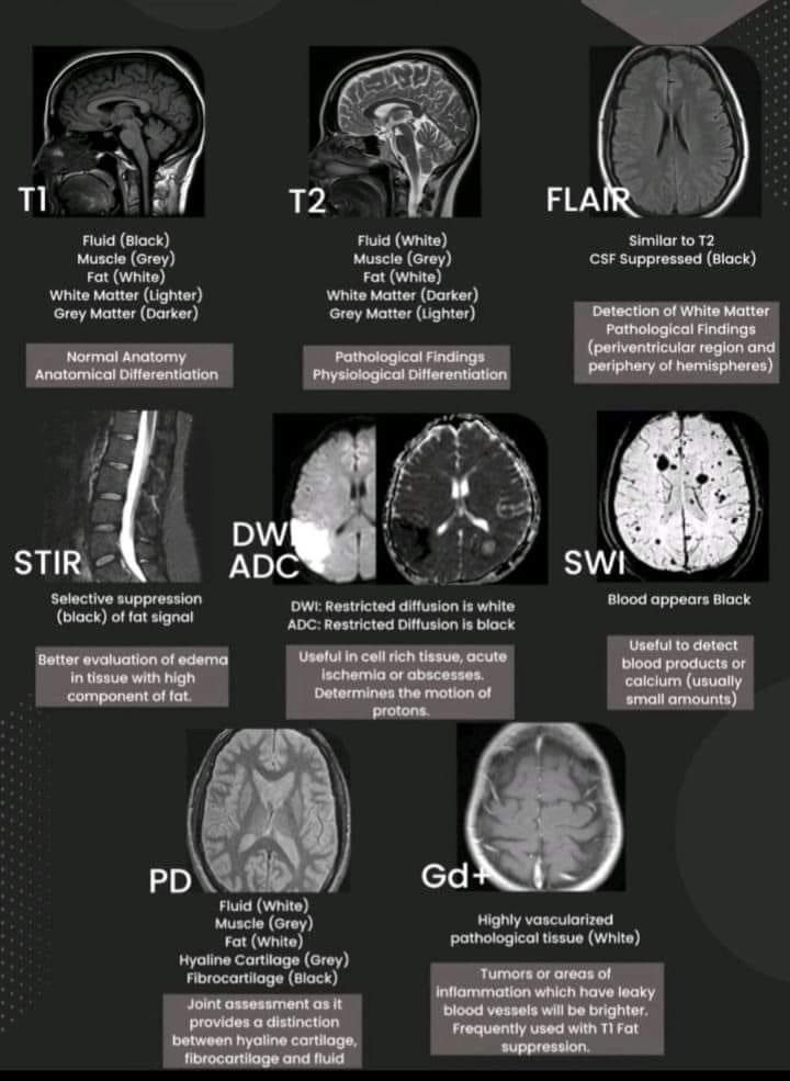 Quick reference for MR sequences / what’s T1 or T2 again?  Source: Radiology 1895