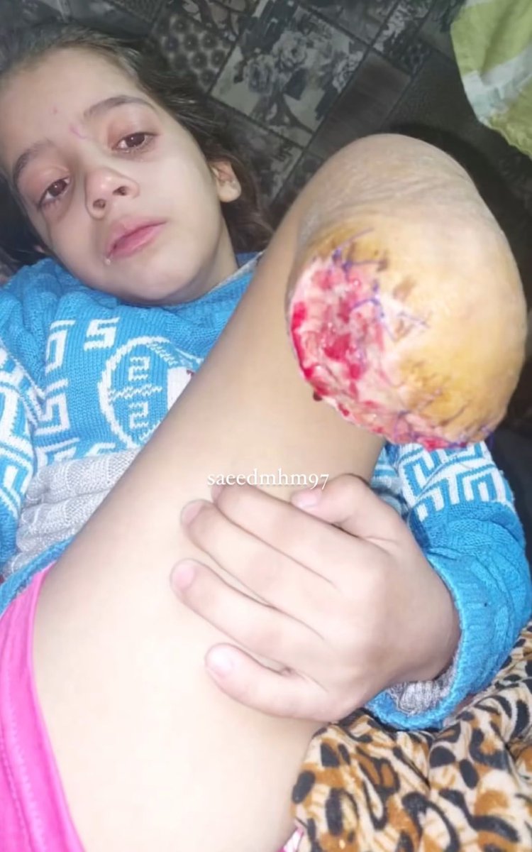 FalasAbuAmal's tweet photo. ¿Tú crees que esta niña perdonará? 

#Israel asesino, esco ria de la humanidad.

#Gaza https://t.co/5YCaMeqkE3