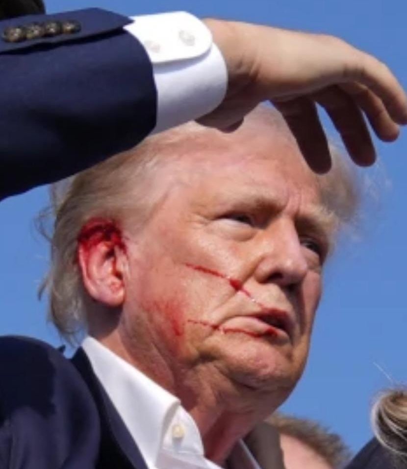 ATENÇÃO: após tiros em seu comício, Donald Trump sai andando, mas sujo de sangue. Lembra muito o Bolsonaro em 2018.