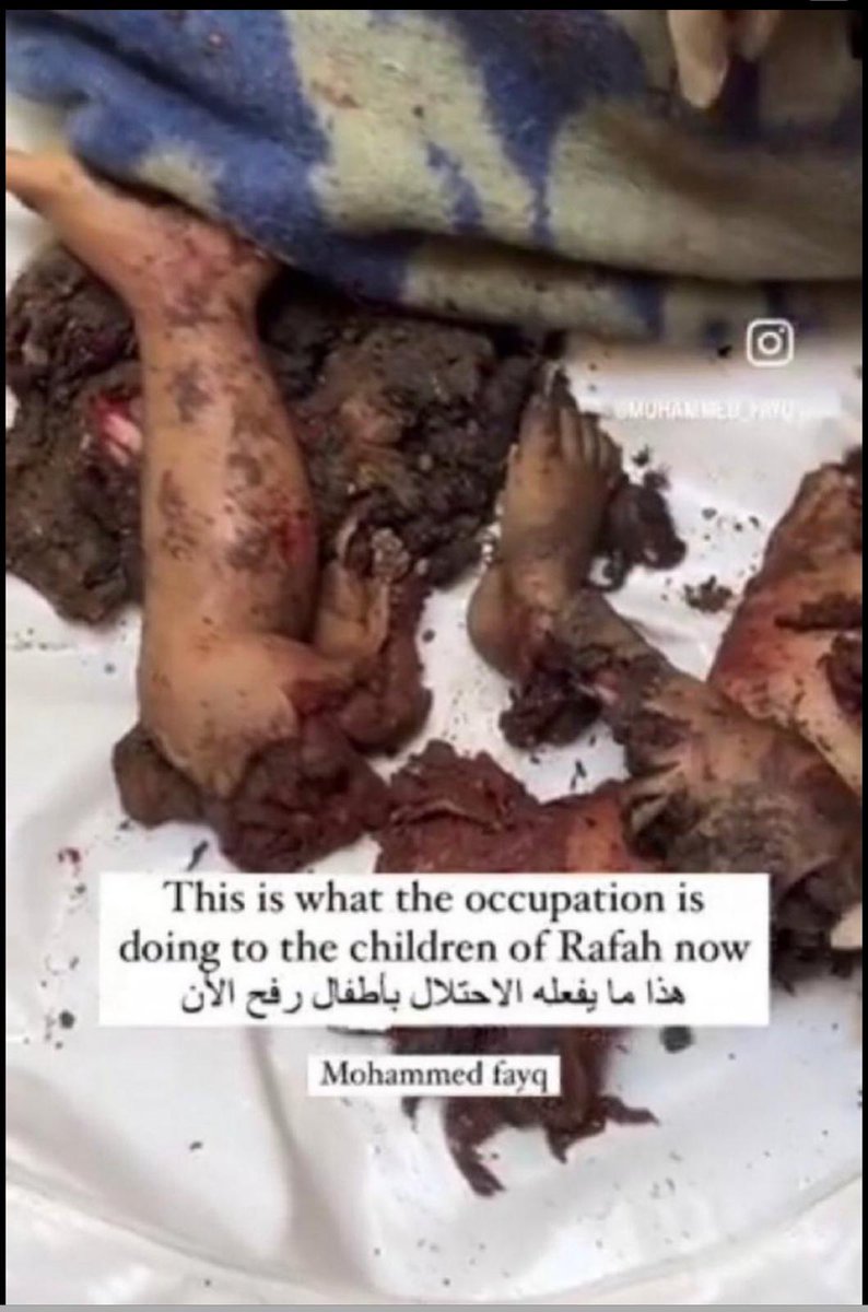 ShaykhSulaiman's tweet photo. ISRAEL DID THIS 

LET THE WORLD KNOW 

ONLY ONE SIDE DOES THIS TO CHILDREN

*nsfw https://t.co/ws8JSIwfzI