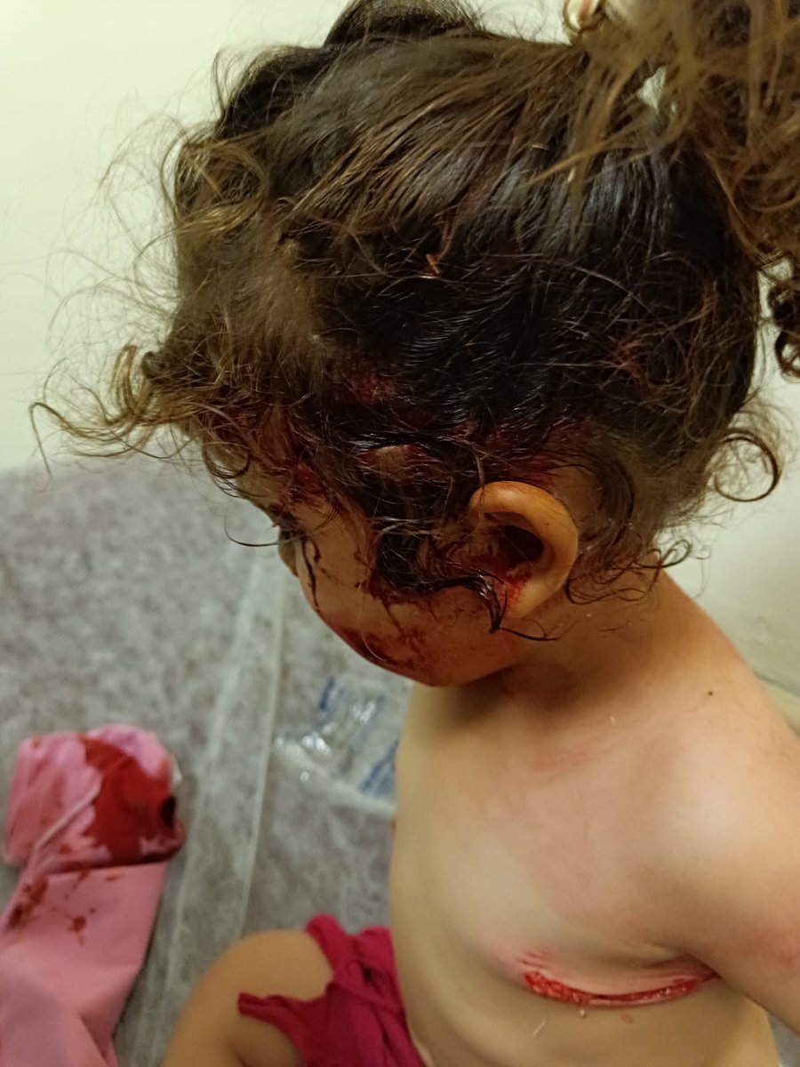 Türk çocuklarını başıboş köpeklere kurban vermemek için #yasayaevet diyoruz.