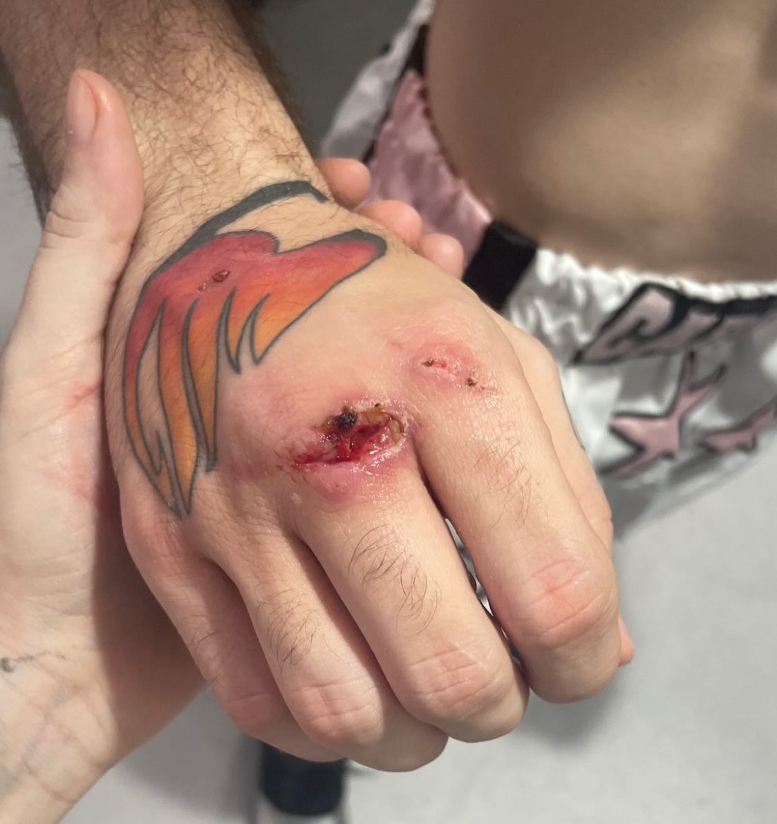 como se ve la mano de un campeón: