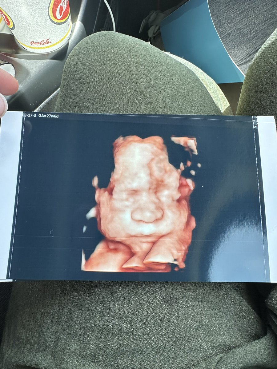 ickiivikki44's tweet photo. @pulte Please help with my registry! I’m due in 2 months and still haven’t gotten anything. You’d be a huge blessing for my baby and I 🙏🏼$vamzilla911 https://t.co/PpVGAzCoqB