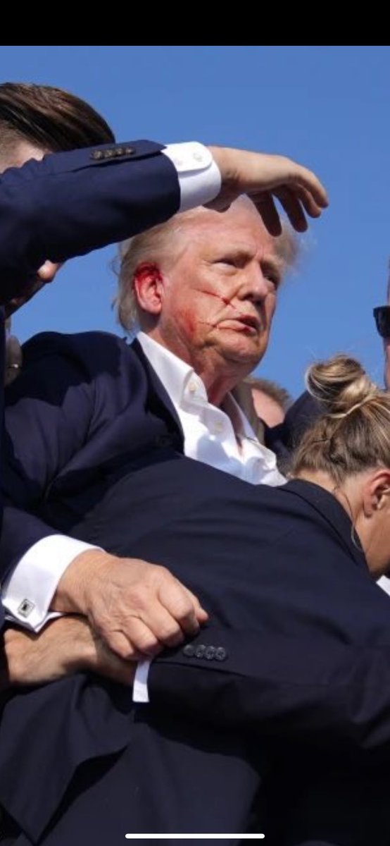 CHEETAHDEMA's tweet image. trump rn vs me (not shot in the ear)