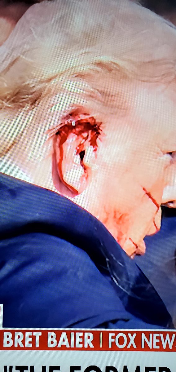 cocando's tweet photo. Atentado contra Trump, presuntamente con un arma de corto calibre, desata interrogantes: ¿Como burló el que disparó los detectores de metales del Servicio Secreto? ¿Quien ordenó el atentado? Sin dudas, un evento que cambia el juego electoral en Estados Unidos. https://t.co/EGtamgsav5