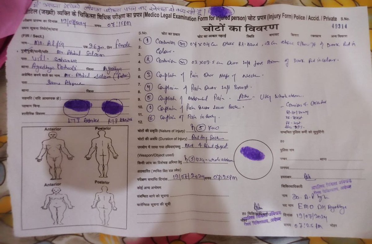 भूतपूर्व सैनिक के साथ डॉक्टरो द्वारा किया गया दुर्व्यवहार और मारपीट करना बेहद निंदनीय है पीड़ित परिवार भूतपूर्व सैनिक को न्याय नहीं मिला तो भीम आर्मी,आजाद समाज पार्टी न्याय दिलाने के लिए आंदोलन करेंगी <a href="/AzadSamajParty/">Aazad Samaj Party - Kanshi Ram</a>
<a href="/Uppolice/">UP POLICE</a> <a href="/ayodhya_police/">AYODHYA POLICE</a> <a href="/CMOfficeUP/">CM Office, GoUP</a> <a href="/igrangeayodhya/">DIG Range Ayodhya</a> <a href="/aajtak/">AajTak</a>