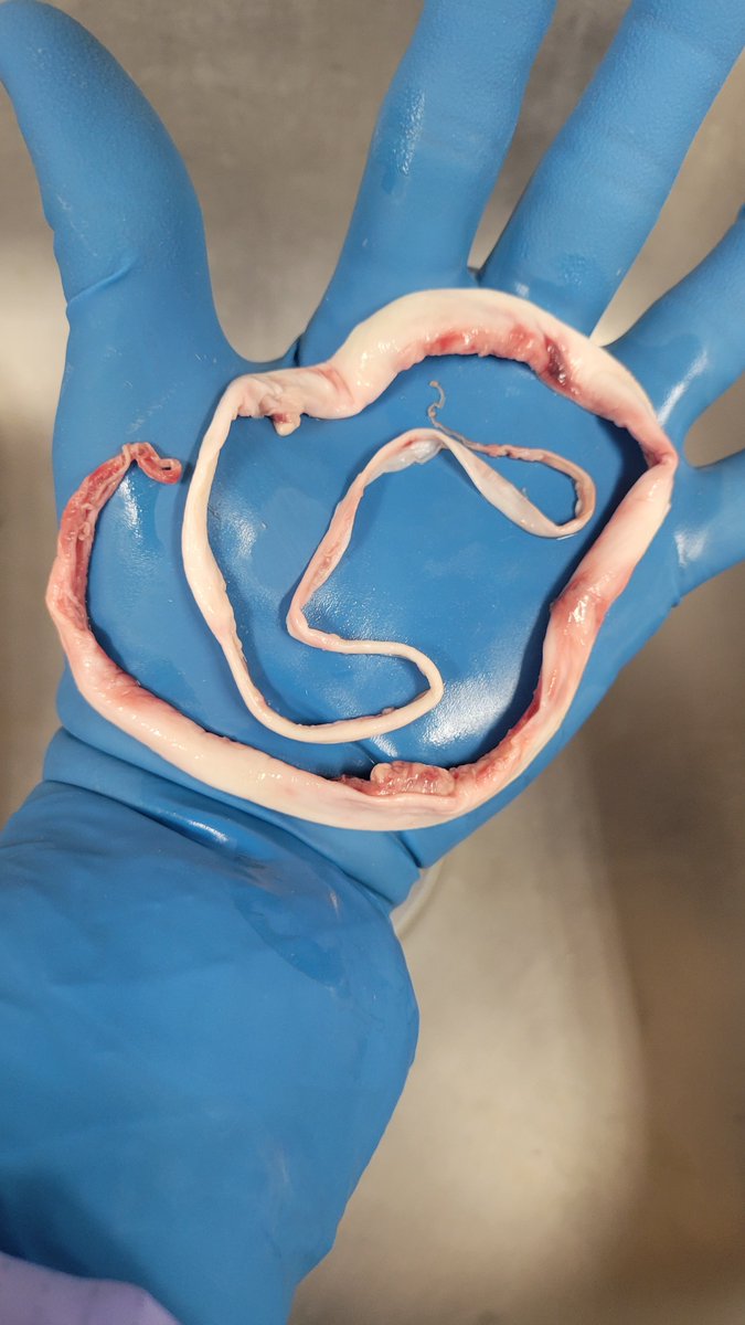 I removed this clot from the iliac artery. It's about 19 inches long and it was removed prior to embalming. 
I never seen clotting like this prior to 2021! 
The first 20 years in my field, I don't ever recall seeing clots like this. I'm not the only embalmer seeing this. 
I