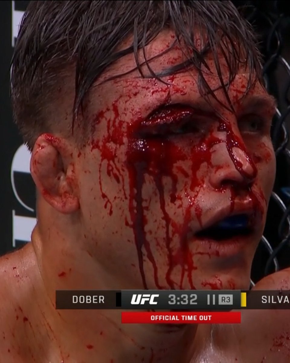 MMAFighting's tweet photo. DOBER'S CUT 😳 #UFCDenver https://t.co/qo4SRLWgBC