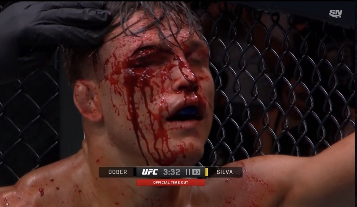 MikeBohn's tweet photo. Drew Dober’s cut. Fight is over. That’s nasty. #UFCDenver https://t.co/aOaYizPKlJ