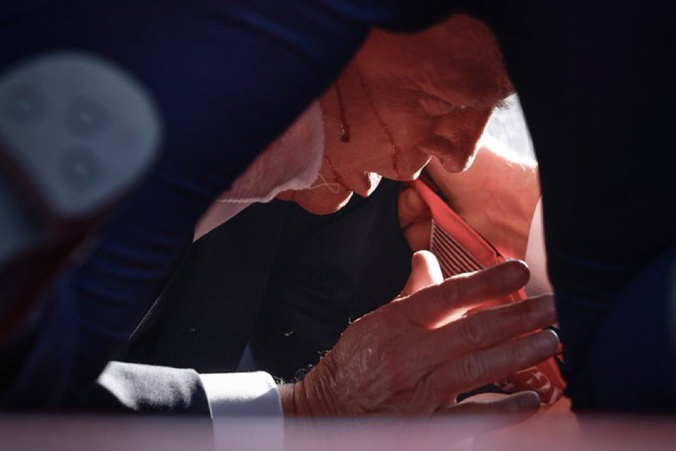 Trump ‘inches away from having face shot open’